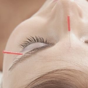 tratamiento de acupuntura durante la menopausia